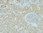 AMACR Monoclonal Antibody(4A12)